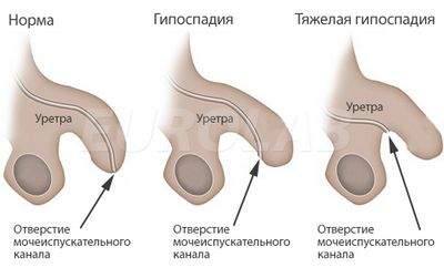 врожденный