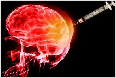 альцгеймера