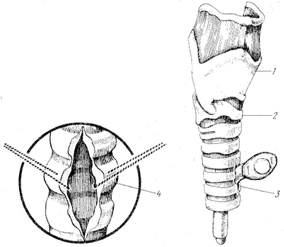 холестерин