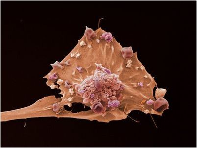 антиокислитель