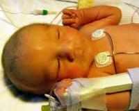 Новые подсказки для лечения синдрома Алажиля от рыбок данио