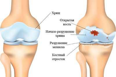 Дендриты Гольджи как ключевая причина дегенеративного заболевания головного мозга